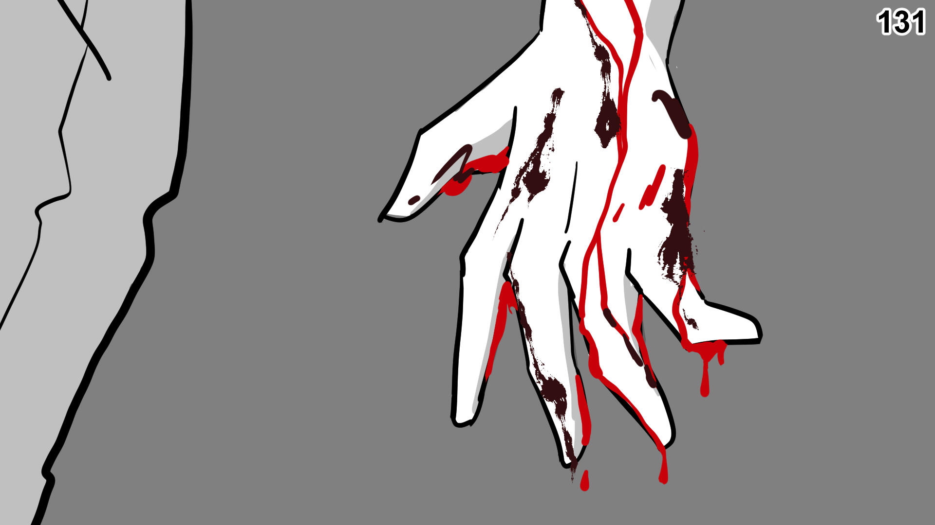 131. Paul&#39;s hand is contaminated with Cara&#39;s infected blood.